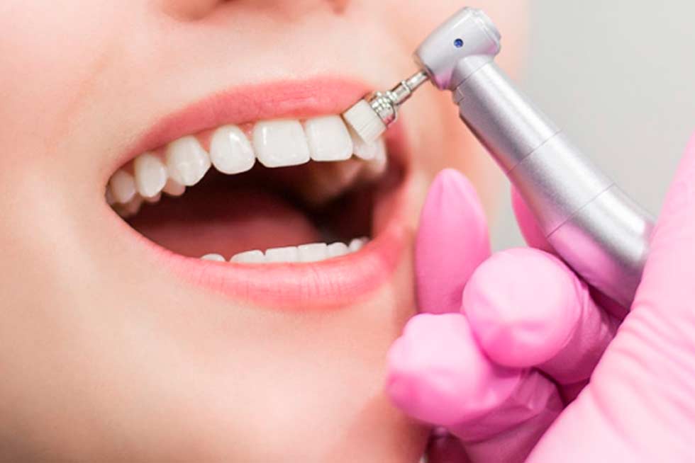 Limpieza Dental Rosarito Baja California